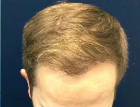 real patient results in Philadelphia ,PA