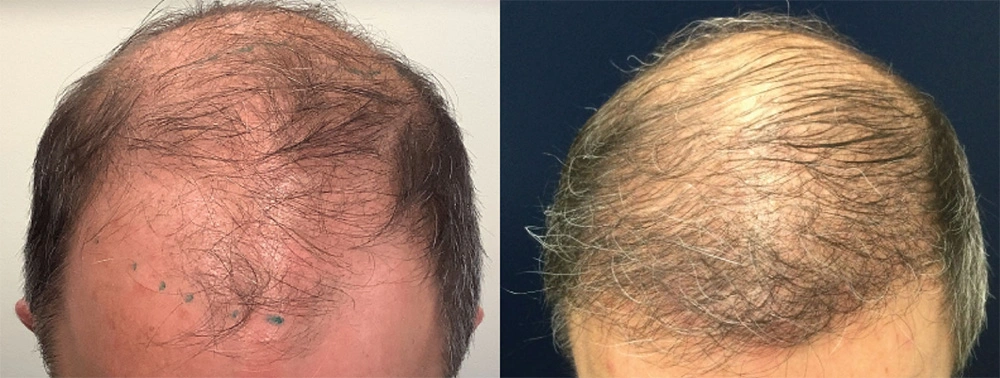 11before.1.jpg