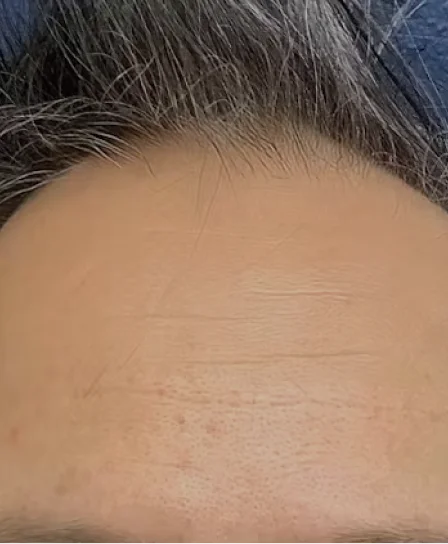 Real patient results in Wayne, PA Morganstern Medical
