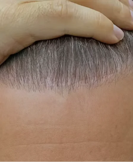 Real patient results in Wayne, PA Morganstern Medical