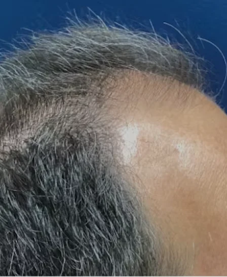 Real patient results in Wayne, PA Morganstern Medical