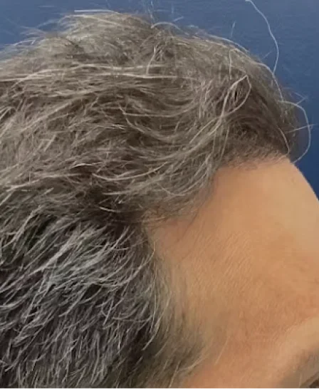 Real patient results in Wayne, PA Morganstern Medical