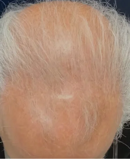 Real patient results in Wayne, PA Morganstern Medical