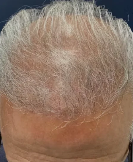 Real patient results in Wayne, PA Morganstern Medical