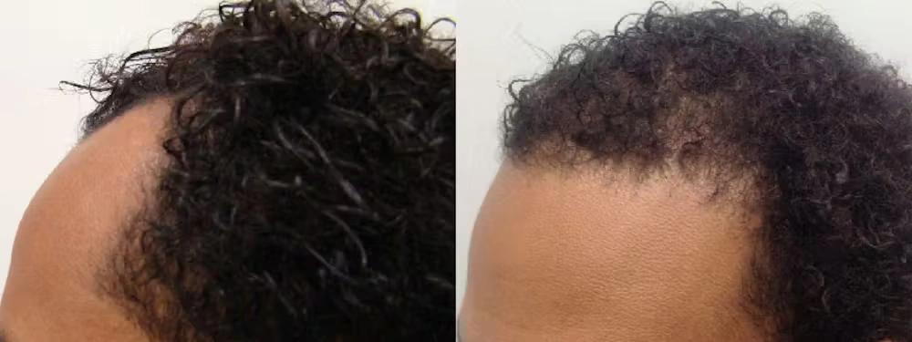 5529-p17-02