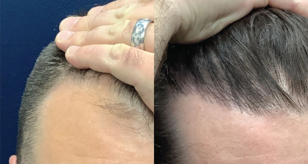 fue-1before.jpg
