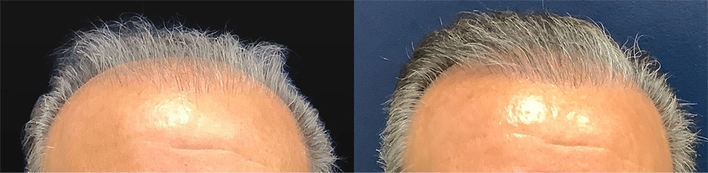 hair-2-before.jpg