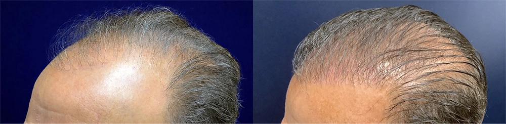 hair-3-before.jpg