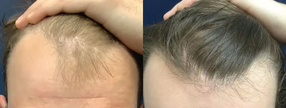 real patient results in Philadelphia ,PA