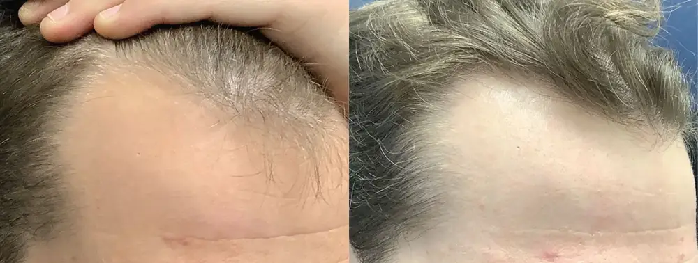 real patient results in Philadelphia ,PA