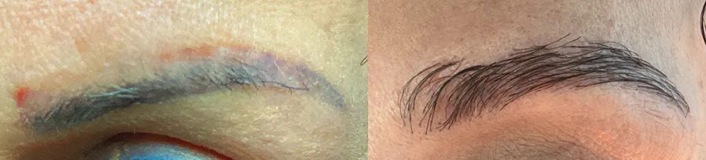 brows.case 1